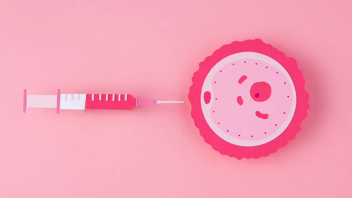 5 Stages Of IVF: IVF இன் 5 நிலைகள் என்ன?